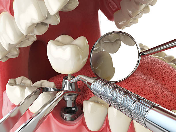 Best Emergency Cosmetic Dentistry (e.g., broken veneers) in Laurence Harbor, NJ